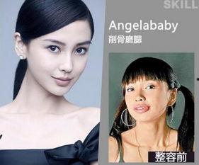 长沙整容爆料案件最新情况,真相大白，受害者权益如何保障？